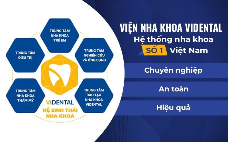 Vidental - Địa chỉ uy tín và chất lượng cho chăm sóc sức khỏe răng miệng